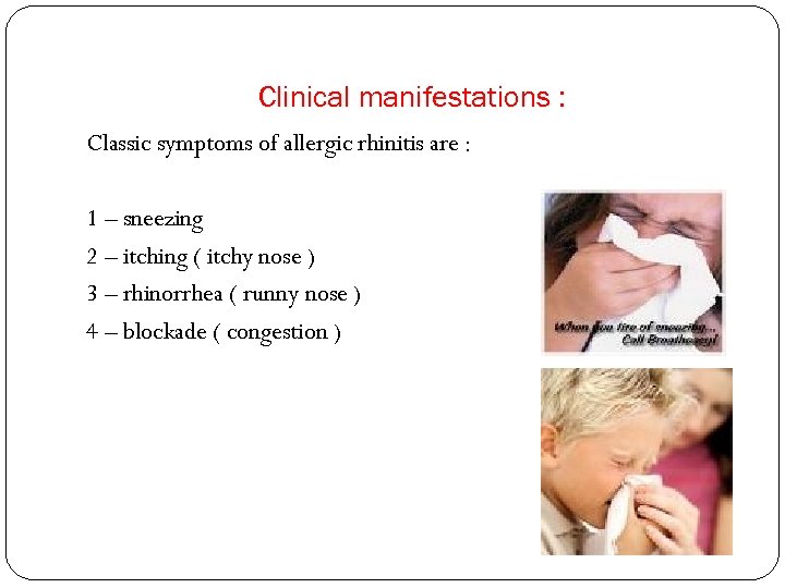 Clinical manifestations : Classic symptoms of allergic rhinitis are : 1 – sneezing 2