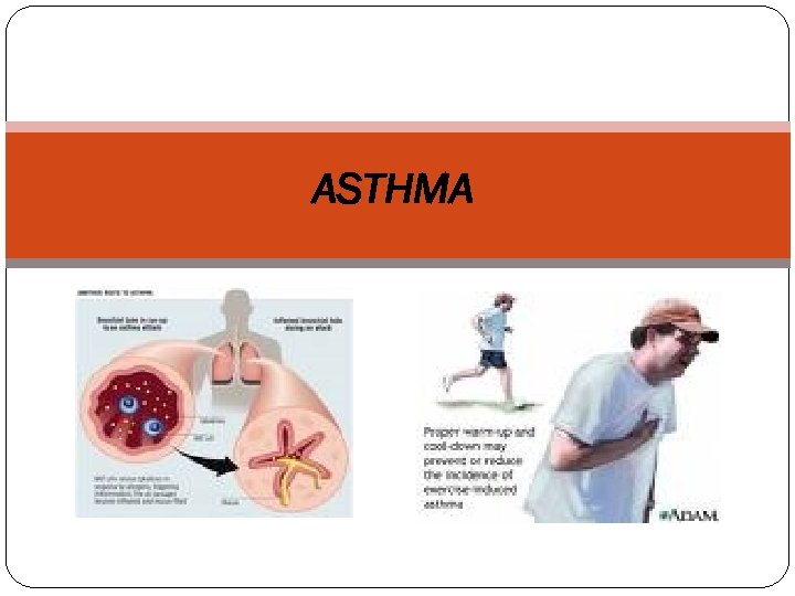 ASTHMA 