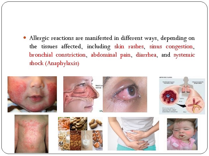  Allergic reactions are manifested in different ways, depending on the tissues affected, including