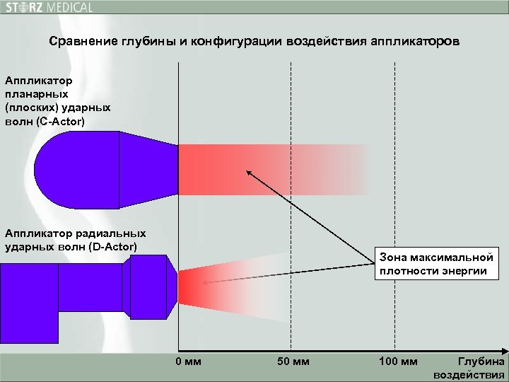 Сравнение глубины и конфигурации воздействия аппликаторов Аппликатор планарных (плоских) ударных волн (С-Actor) Аппликатор радиальных