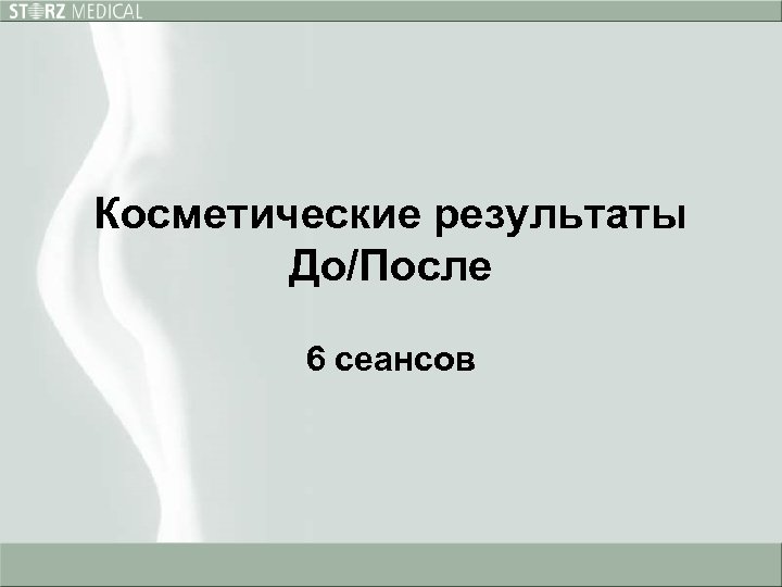 Косметические результаты До/После 6 сеансов 