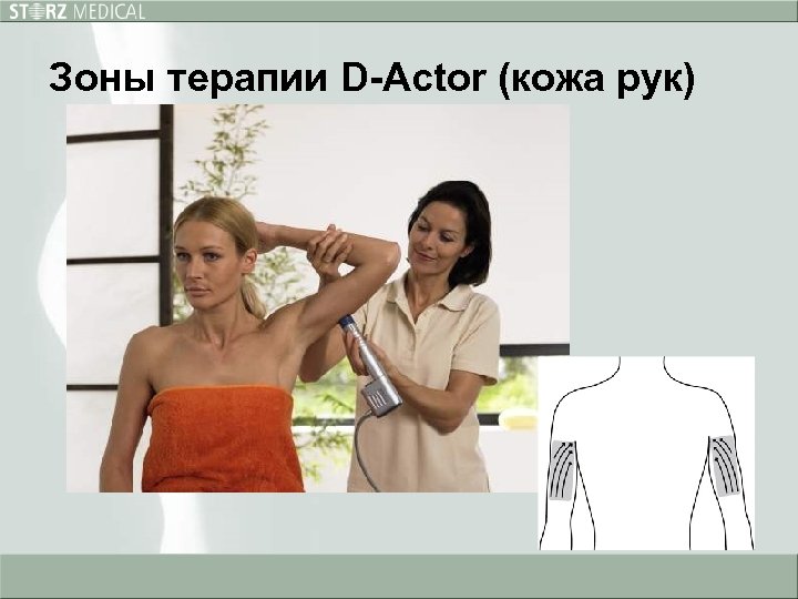 Зоны терапии D-Actor (кожа рук) 
