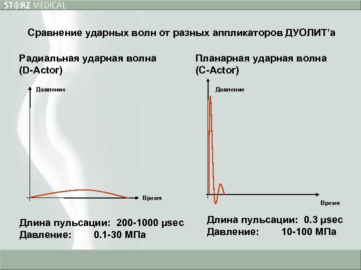 Сравнение ударных волн от разных аппликаторов ДУОЛИТ’а Радиальная ударная волна (D-Actor) Давление Планарная ударная