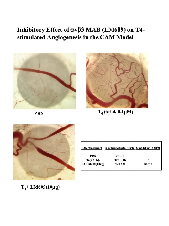 Inhibitory Effect of vb 3 MAB (LM 609) on T 4 stimulated Angiogenesis in