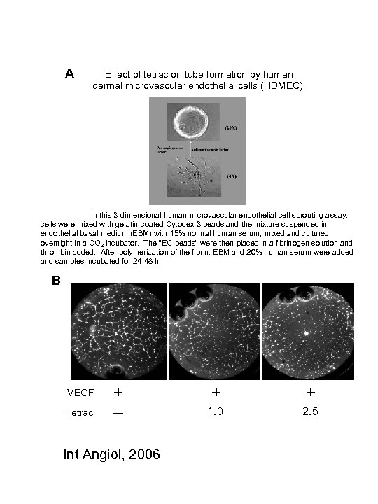 A Effect of tetrac on tube formation by human dermal microvascular endothelial cells (HDMEC).