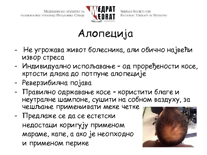 Алопеција - Не угрожава живот болесника, али обично највећи извор стреса - Индивидуално испољавање