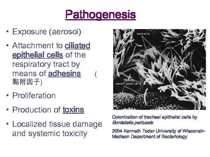 Pathogenesis • Exposure (aerosol) • Attachment to ciliated epithelial cells of the respiratory tract