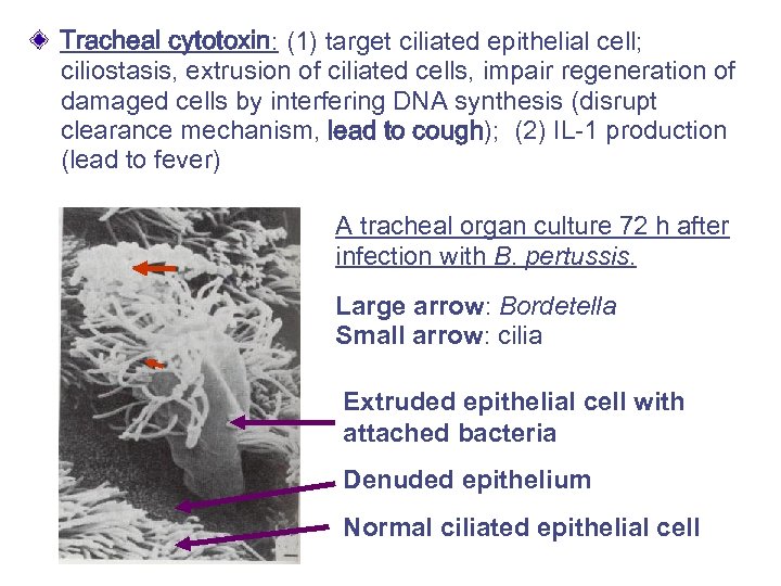 Tracheal cytotoxin: (1) target ciliated epithelial cell; ciliostasis, extrusion of ciliated cells, impair regeneration