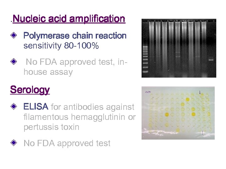 . Nucleic acid amplification Polymerase chain reaction sensitivity 80 -100% No FDA approved test,