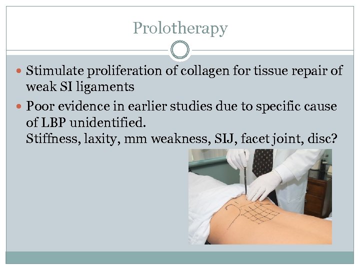 Prolotherapy Stimulate proliferation of collagen for tissue repair of weak SI ligaments Poor evidence