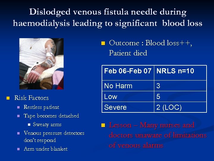 Dislodged venous fistula needle during haemodialysis leading to significant blood loss n Outcome :
