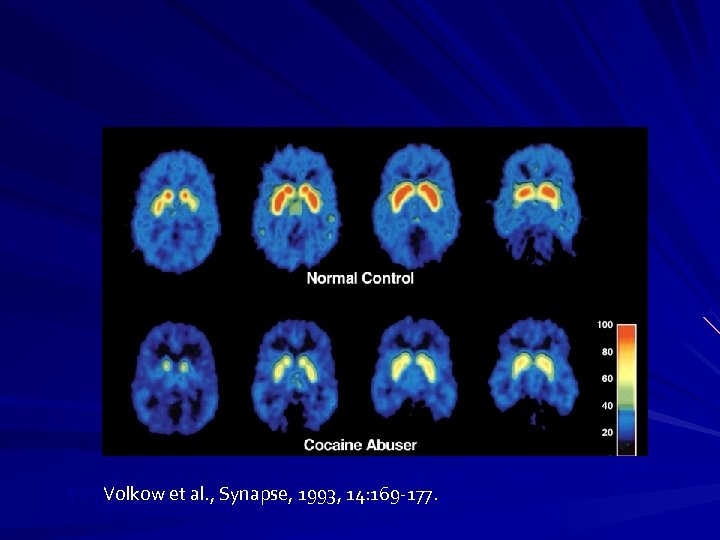 VVVVolkow et al. , Synapse, 1993, 14: 169 -177. 