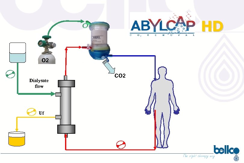 HD O 2 Dialysate flow Uf CO 2 