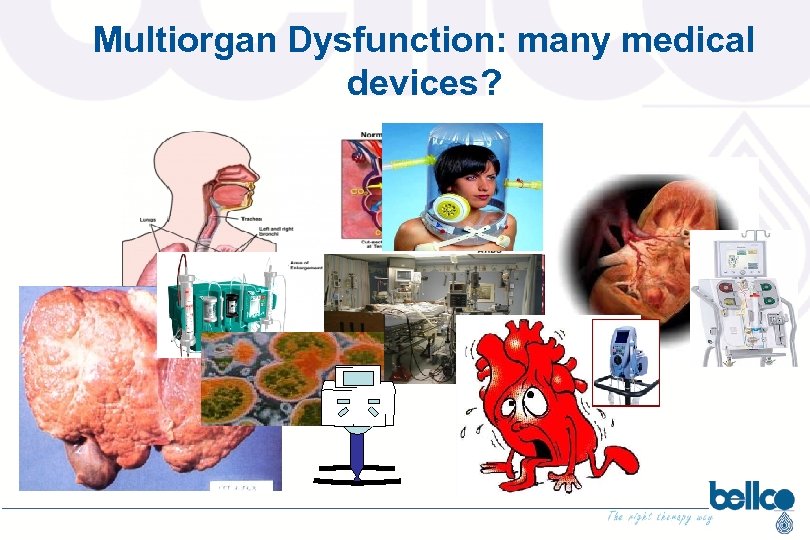 Multiorgan Dysfunction: many medical devices? 