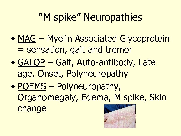 “M spike” Neuropathies • MAG – Myelin Associated Glycoprotein = sensation, gait and tremor