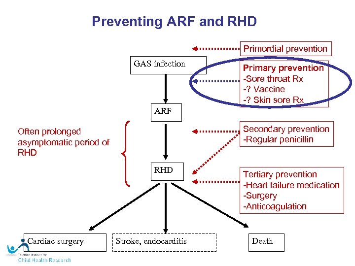 Preventing ARF and RHD Primordial prevention GAS infection Primary prevention -Sore throat Rx -?