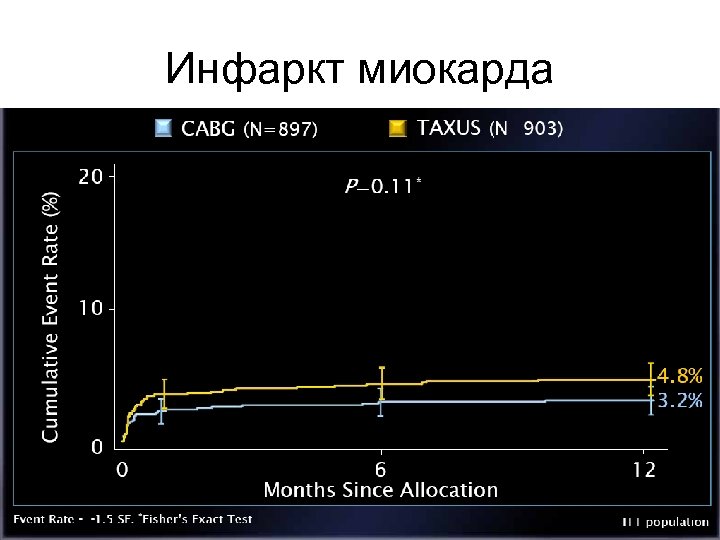 Инфаркт миокарда 