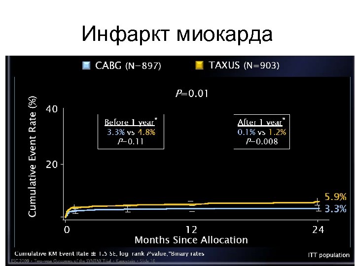 Инфаркт миокарда 
