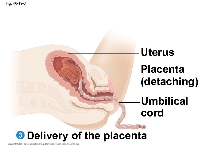 Fig. 46 -19 -3 Uterus Placenta (detaching) Umbilical cord 3 Delivery of the placenta