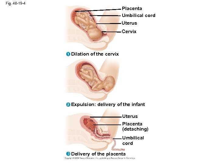 Fig. 46 -19 -4 Placenta Umbilical cord Uterus Cervix 1 Dilation of the cervix
