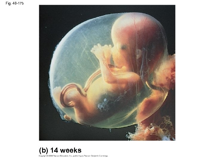 Fig. 46 -17 b (b) 14 weeks 