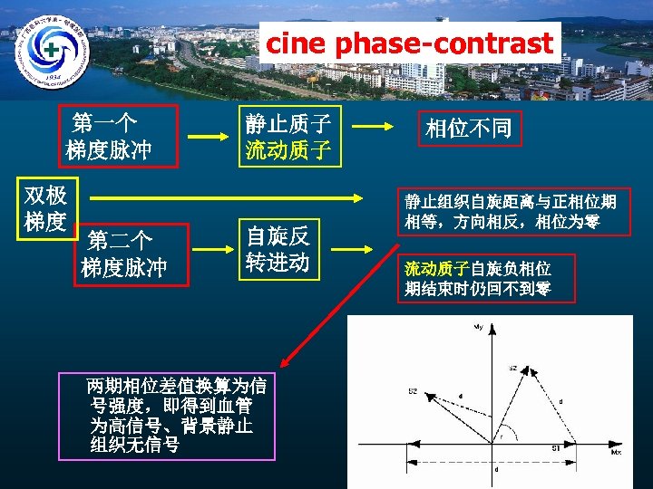 cine phase-contrast 第一个 梯度脉冲 双极 梯度 第二个 梯度脉冲 静止质子 流动质子 自旋反 转进动 两期相位差值换算为信 号强度，即得到血管