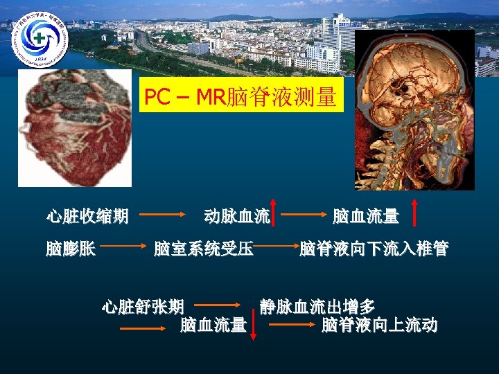 PC – MR脑脊液测量 心脏收缩期 脑膨胀 动脉血流 脑室系统受压 脑血流量 脑脊液向下流入椎管 心脏舒张期 静脉血流出增多 脑血流量 脑脊液向上流动 