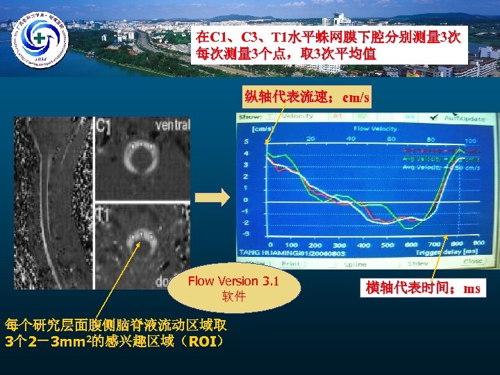 在C 1、C 3、T 1水平蛛网膜下腔分别测量 3次 每次测量 3个点，取 3次平均值 纵轴代表流速；cm/s Flow Version 3. 1 软件