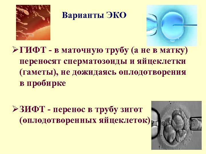 Варианты ЭКО Ø ГИФТ - в маточную трубу (а не в матку) переносят сперматозоиды