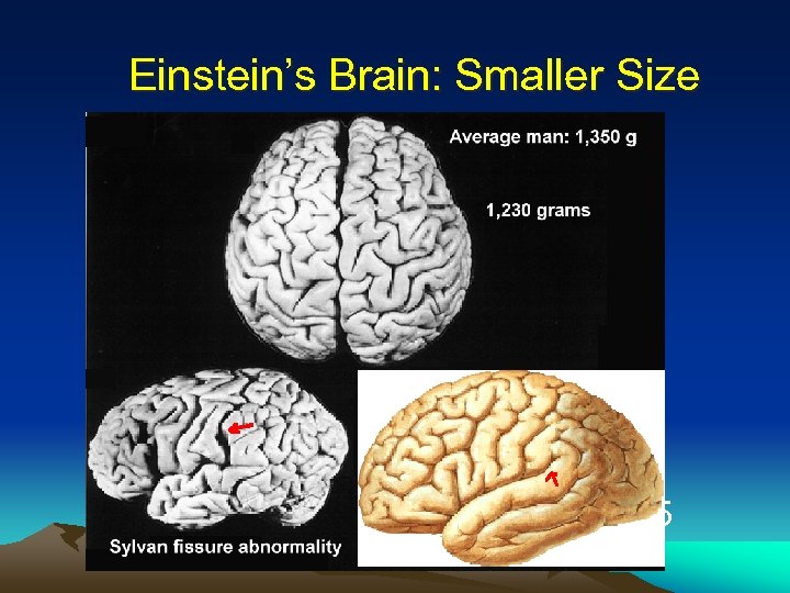 Einstein’s Brain: Smaller Size • 1879 -1955 