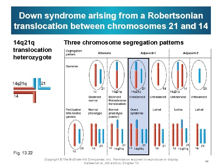 Down syndrome arising from a Robertsonian translocation between chromosomes 21 and 14 14 q