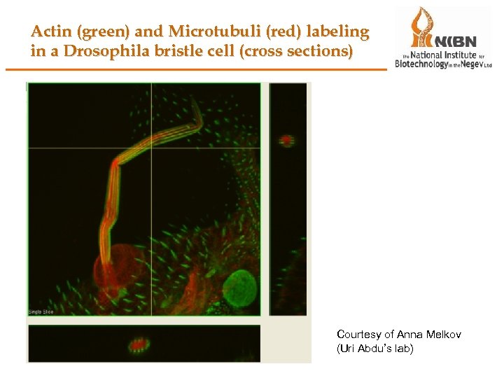 Actin (green) and Microtubuli (red) labeling in a Drosophila bristle cell (cross sections) Courtesy