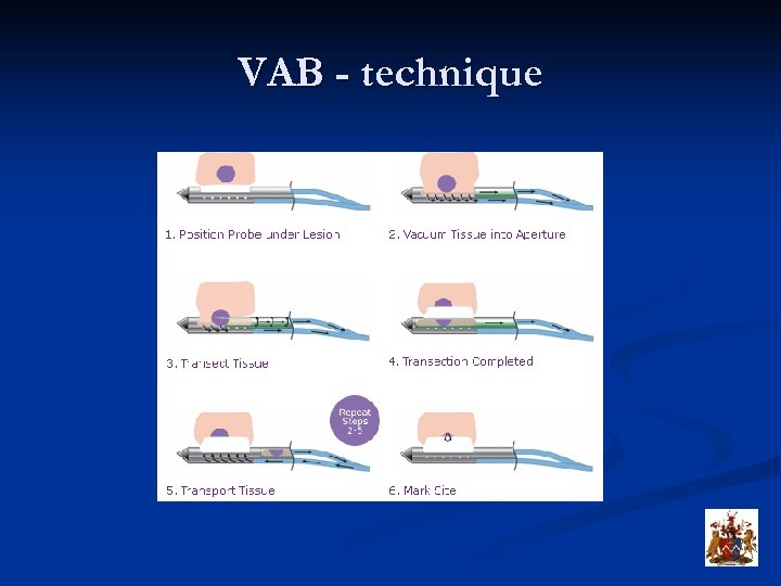 VAB - technique 