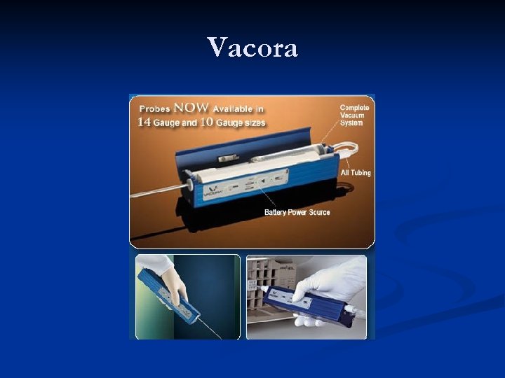 Vacora 