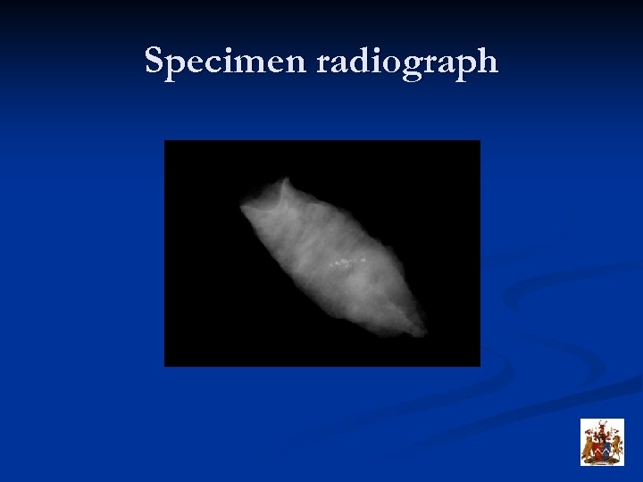 Specimen radiograph 