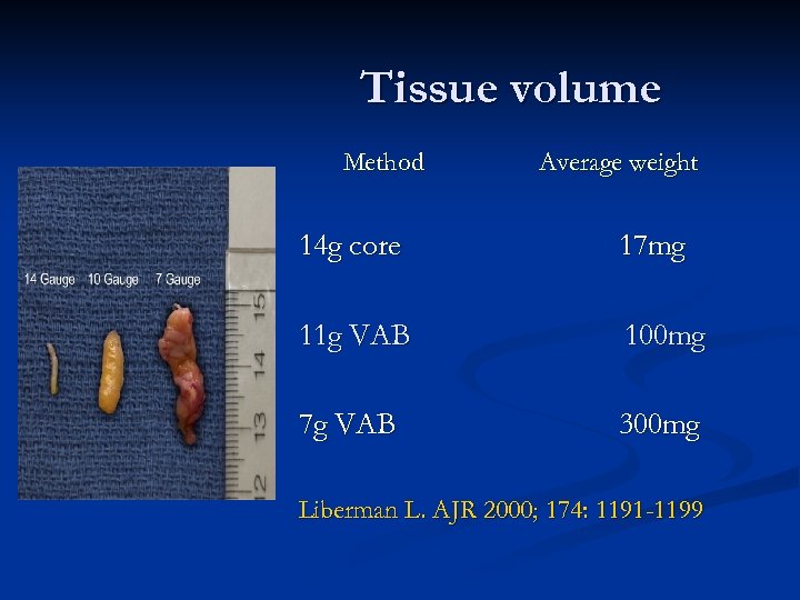 Tissue volume Method Average weight 14 g core 17 mg 11 g VAB 100