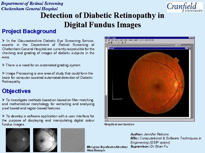 Department of Retinal Screening Cheltenham General Hospital Detection of Diabetic Retinopathy in Digital Fundus