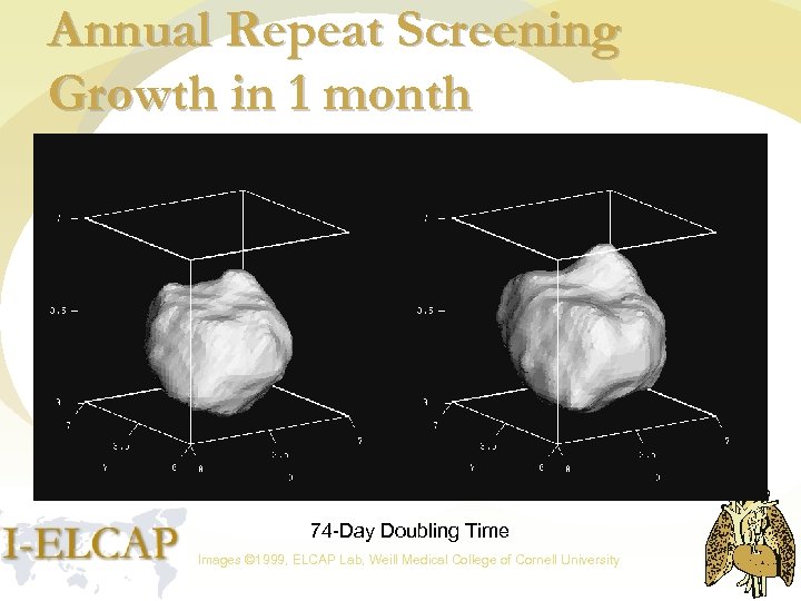 Annual Repeat Screening Growth in 1 month 74 -Day Doubling Time Images © 1999,