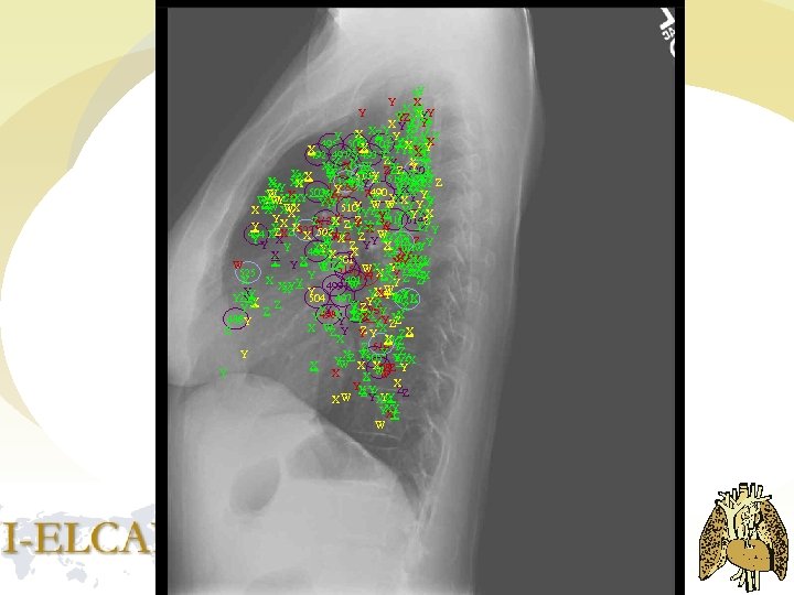 Y X Y YY X X Y Y Y ZZX Y Y YW Y