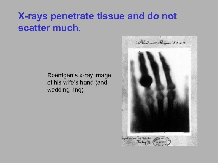 X-rays penetrate tissue and do not scatter much. Roentgen’s x-ray image of his wife’s