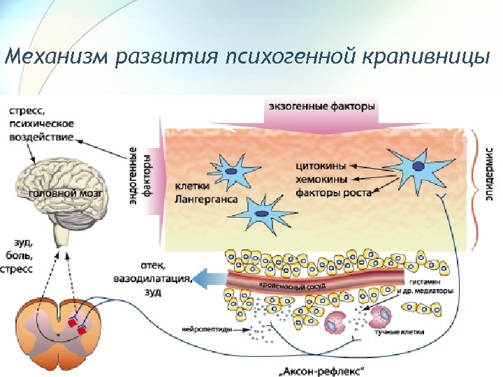 Крапивница и ангиоэдема этиология патогенез клиническая картина диагностика лечение