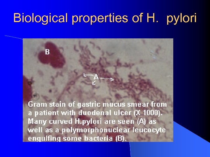 Biological properties of H. pylori 