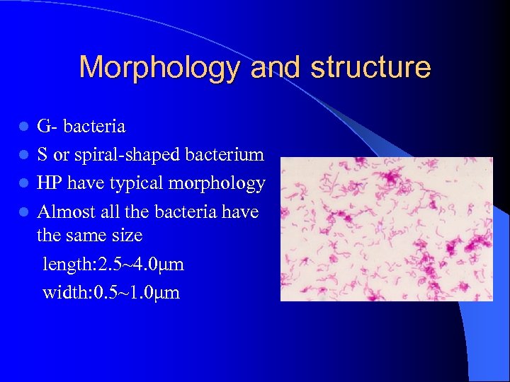 Morphology and structure G- bacteria l S or spiral-shaped bacterium l HP have typical