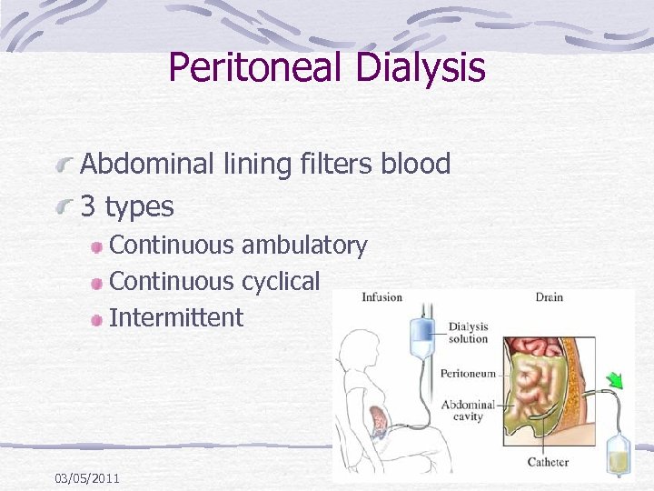 Peritoneal Dialysis Abdominal lining filters blood 3 types Continuous ambulatory Continuous cyclical Intermittent 03/05/2011