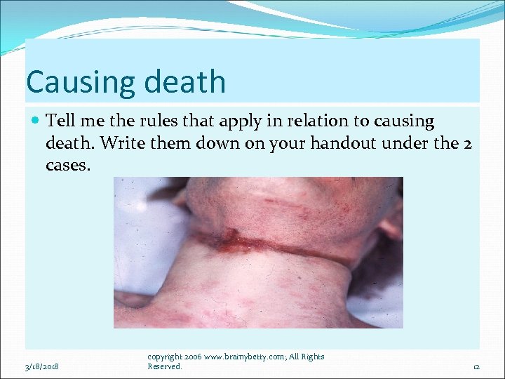 Causing death Tell me the rules that apply in relation to causing death. Write