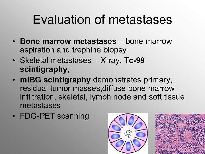 Evaluation of metastases • Bone marrow metastases – bone marrow aspiration and trephine biopsy