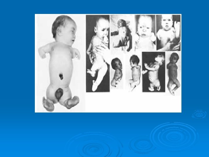 What prompted their start? 