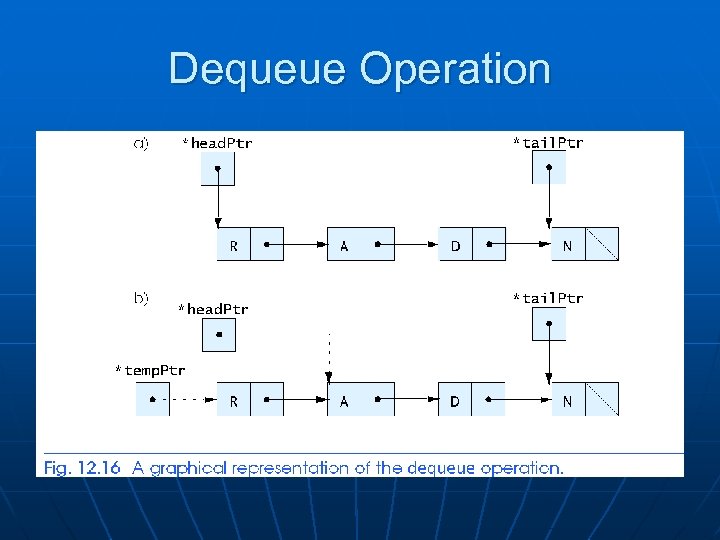 Dequeue Operation 