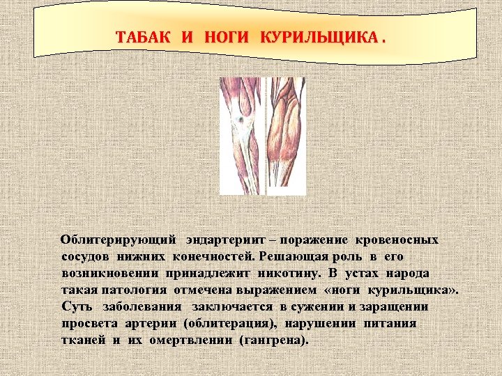 ТАБАК И НОГИ КУРИЛЬЩИКА. Облитерирующий эндартериит – поражение кровеносных сосудов нижних конечностей. Решающая роль