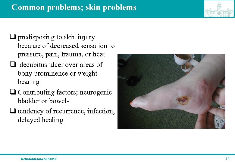 Common problems; skin problems q predisposing to skin injury because of decreased sensation to